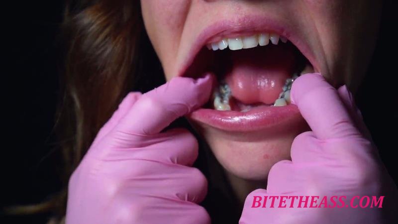  Destines Dungeon - 10 Minute Silver Fillings [FullHD 1080]
